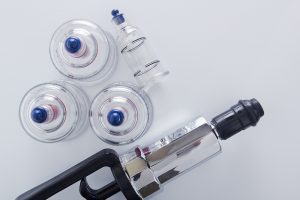 What is Cupping?