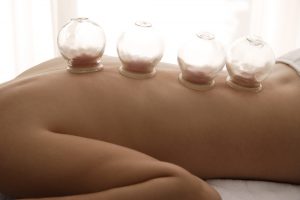 Cupping and Sensation