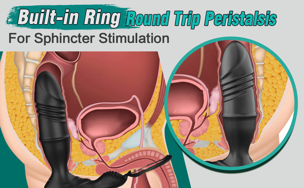 Built-in Ring Round Trip Peristalsis For Sphincter Stimulation